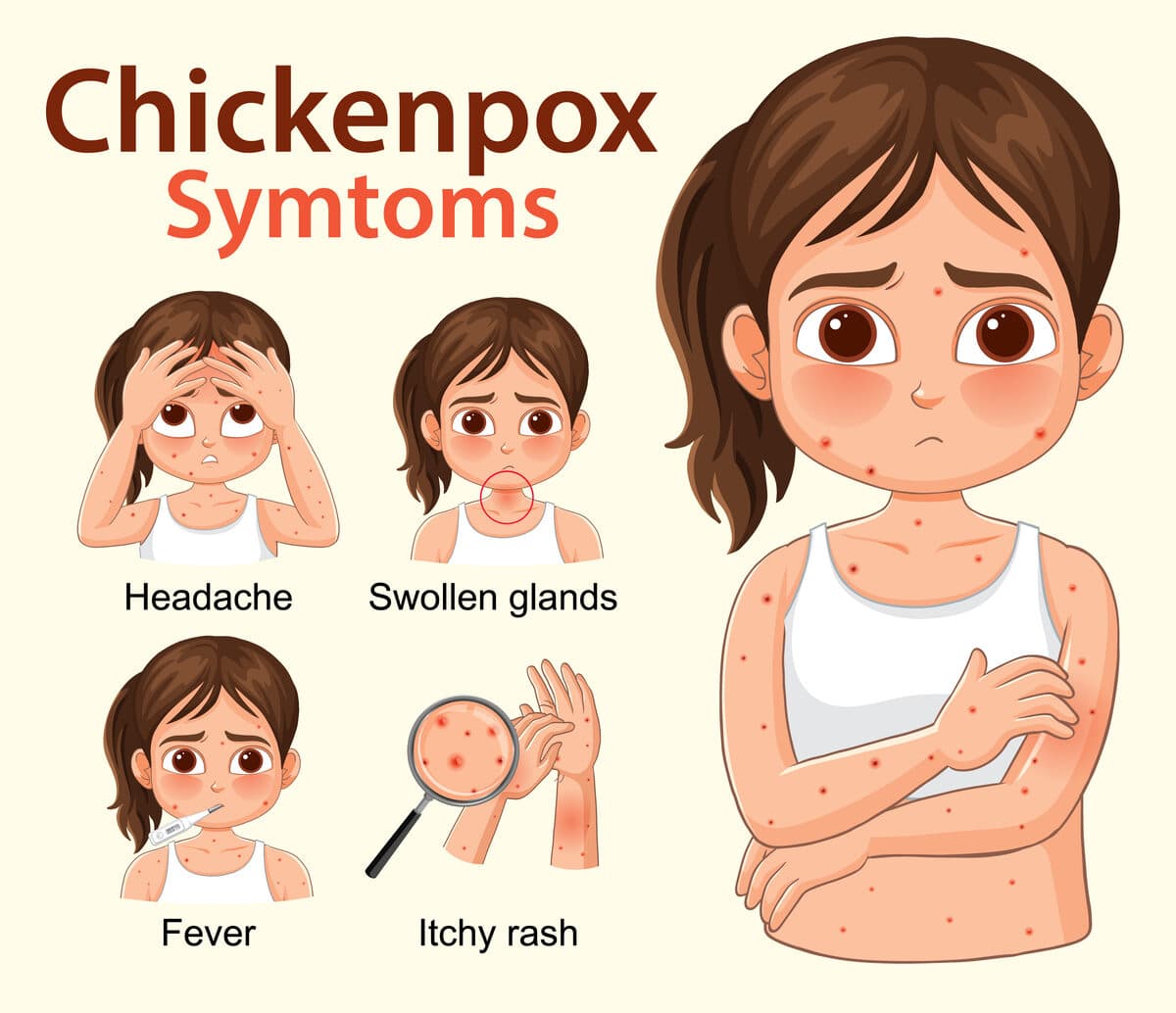 Child with chickenpox rash — community health alert from Hummingbird Pediatrics